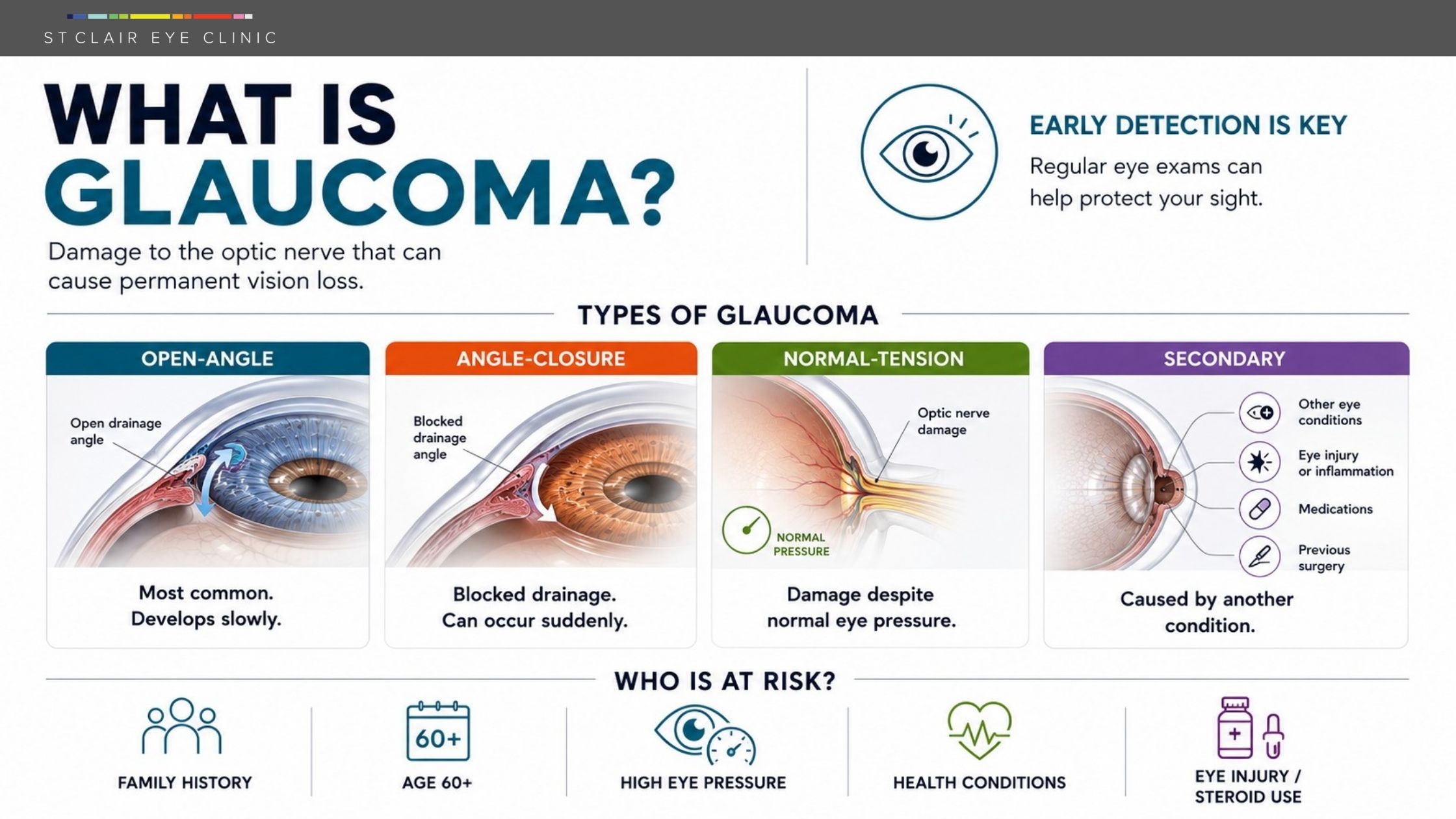 Infographic explaining open-angle, angle-closure, normal-tension, and secondary glaucoma, along with common glaucoma risk factors