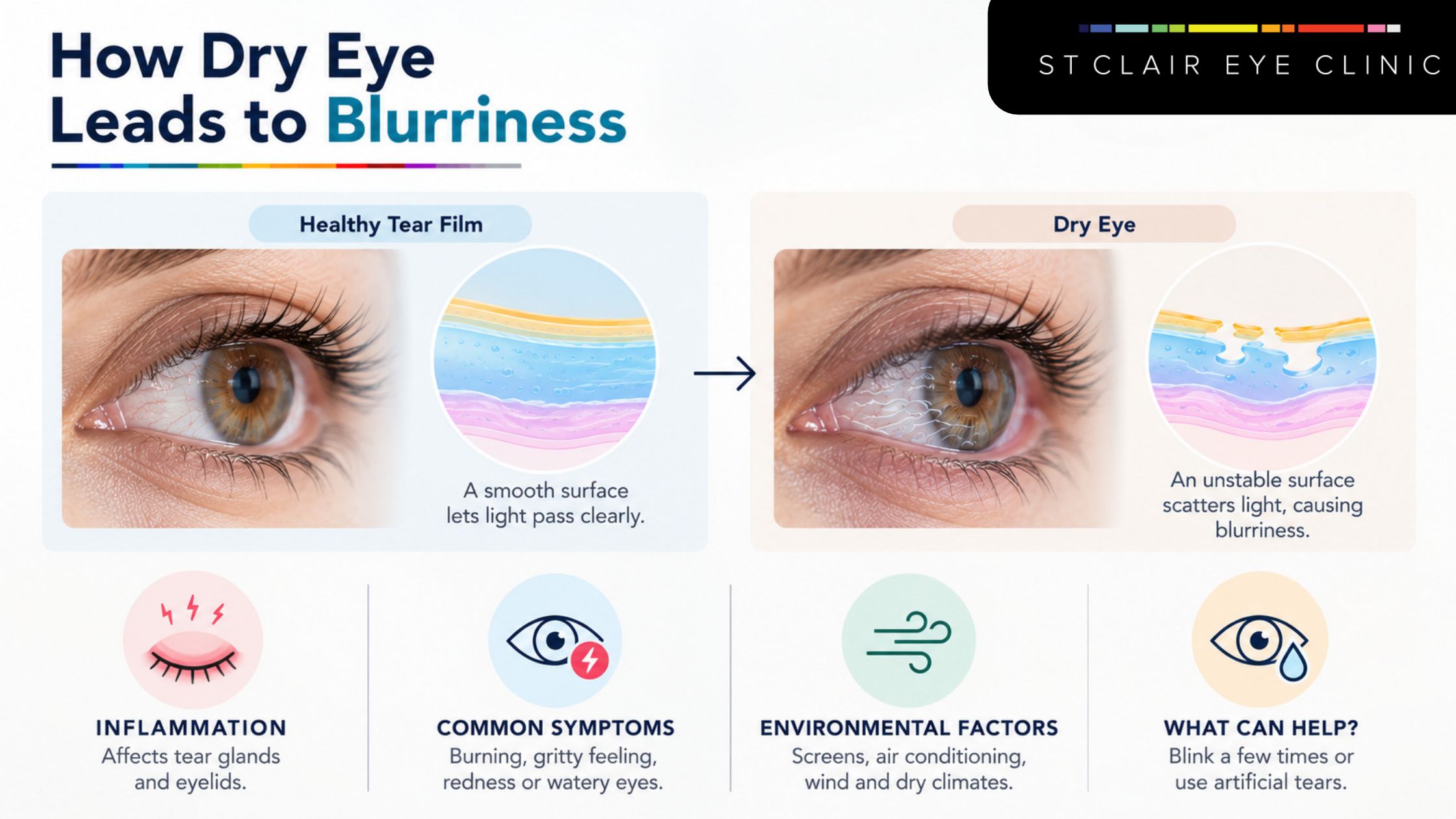 Infographic explaining how dry eye disrupts the tear film and causes blurry vision, with common symptoms, environmental factors, and relief tips.