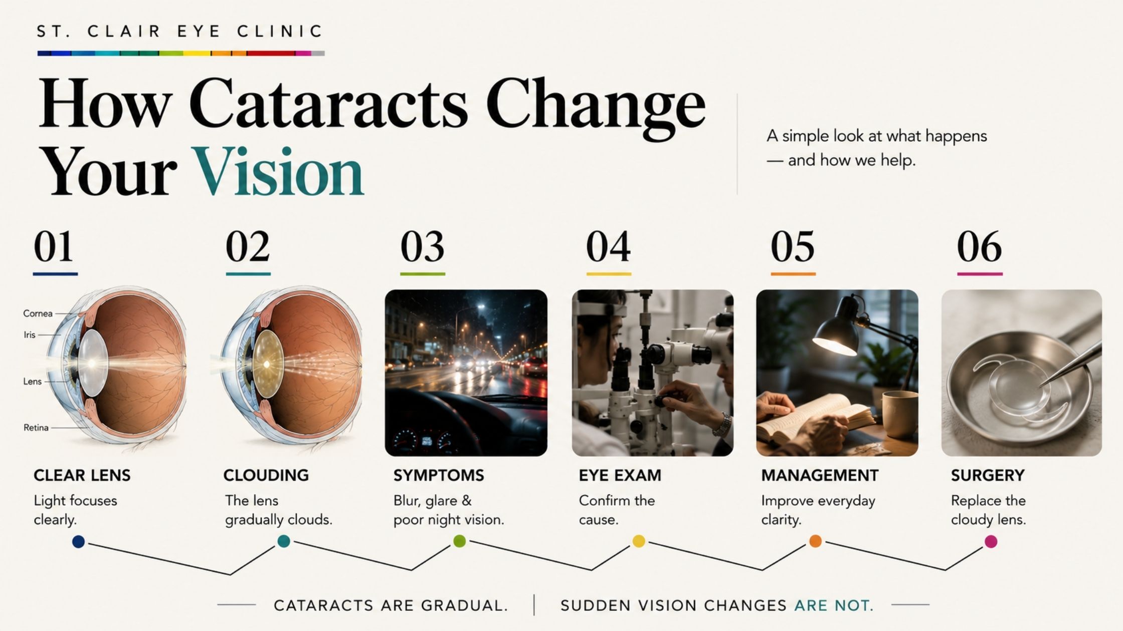Infographic explaining how cataracts progress from a clear lens to clouding, vision symptoms, eye examination, management, and cataract surger